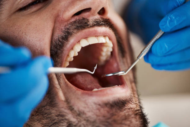 Best Emergency Care for Gum Disease in Tuckahoe, VA
