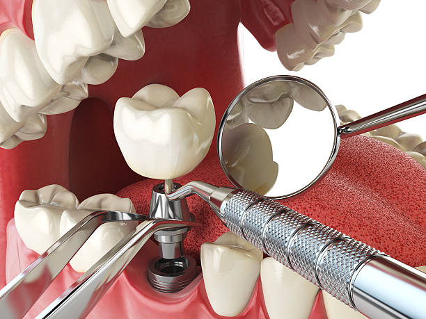 Trusted VA Emergency Dental Service Experts